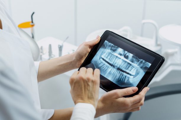 Dentist Showing X Ray Picture To Her Patient